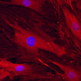 CD105 Antibody in Immunocytochemistry (ICC/IF)