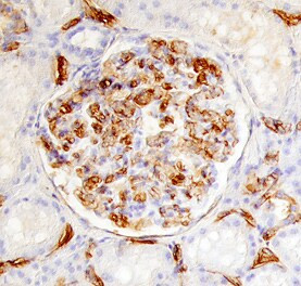 IL17RD Antibody in Immunohistochemistry (Paraffin) (IHC (P))