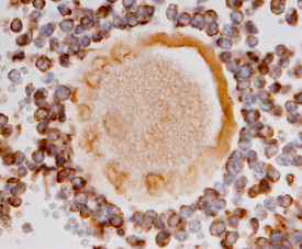 AMHR2 Antibody in Immunohistochemistry (Paraffin) (IHC (P))