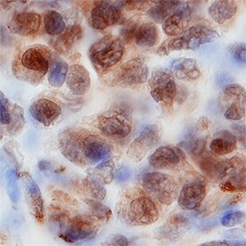 WDR5 Antibody in Immunohistochemistry (Paraffin) (IHC (P))