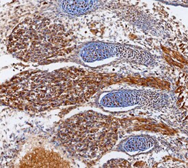 ADAMTS1 Antibody in Immunohistochemistry (Frozen) (IHC (F))