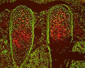 TSG Antibody in Immunohistochemistry (Frozen) (IHC (F))