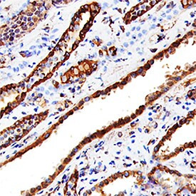 Cathepsin L Antibody in Immunohistochemistry (Paraffin) (IHC (P))