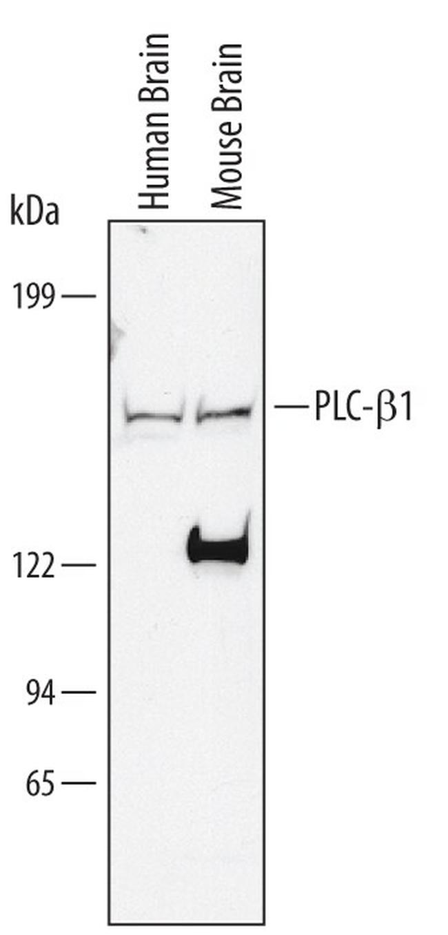 PLCB1 Antibody in Western Blot (WB)