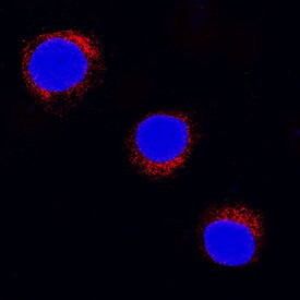 SOCS5 Antibody in Immunocytochemistry (ICC/IF)