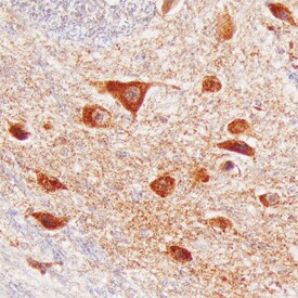 VWC2 Antibody in Immunohistochemistry (Paraffin) (IHC (P))