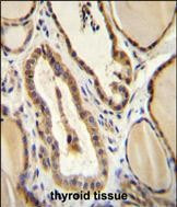 PGCD Antibody in Immunohistochemistry (Paraffin) (IHC (P))