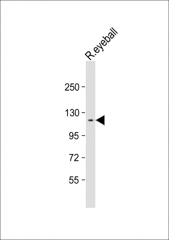 PGCD Antibody in Western Blot (WB)