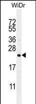 hCG_1657980 Antibody in Western Blot (WB)