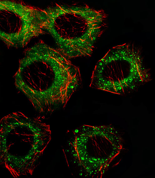 FADS2 Antibody in Immunocytochemistry (ICC/IF)