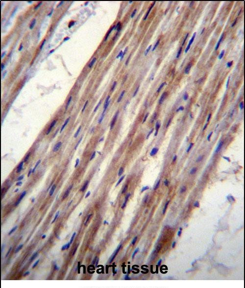 Kir6.1 (KCNJ8) Antibody in Immunohistochemistry (Paraffin) (IHC (P))