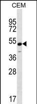 Kir6.1 (KCNJ8) Antibody in Western Blot (WB)