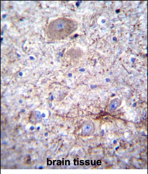 PCDHA7 Antibody in Immunohistochemistry (Paraffin) (IHC (P))