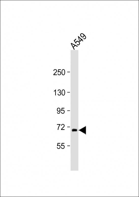 RNF43 Antibody in Western Blot (WB)