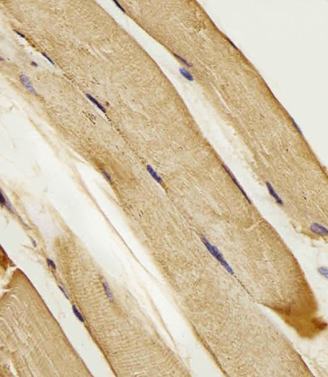 SLC16A10 Antibody in Immunohistochemistry (Paraffin) (IHC (P))