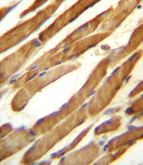 SLC16A10 Antibody in Immunohistochemistry (Paraffin) (IHC (P))