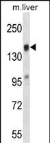 TIAM2 Antibody in Western Blot (WB)