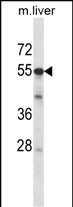 ADCK2 Antibody in Western Blot (WB)