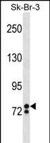 ZNF263 Antibody in Western Blot (WB)