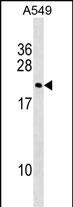 DUX3 Antibody in Western Blot (WB)