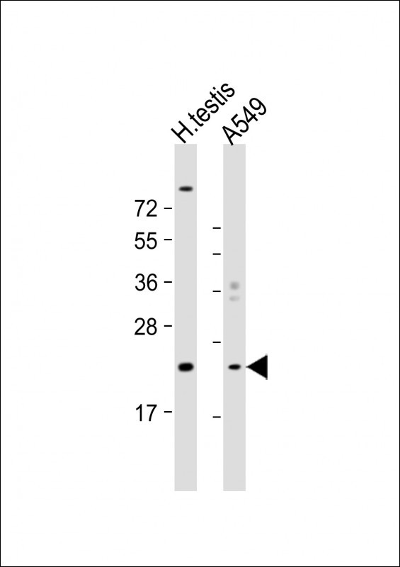 HSPB9 Antibody in Western Blot (WB)