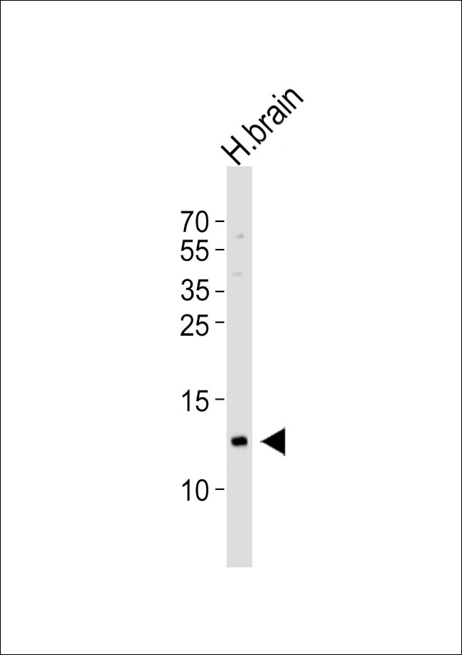 HBG2 Antibody in Western Blot (WB)