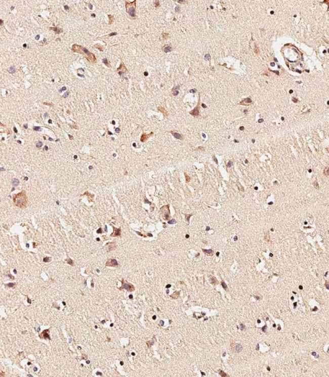 KMT2D Antibody in Immunohistochemistry (Paraffin) (IHC (P))