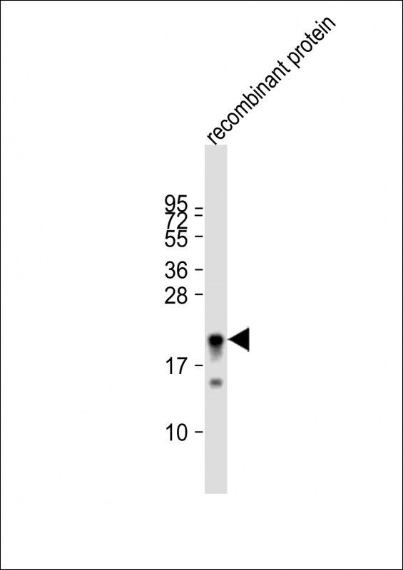 KMT2D Antibody in Western Blot (WB)