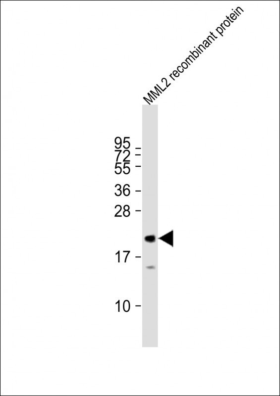 KMT2D Antibody in Western Blot (WB)