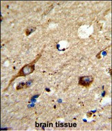 AGPAT3 Antibody in Immunohistochemistry (Paraffin) (IHC (P))