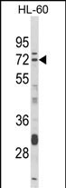 DTX4 Antibody in Western Blot (WB)