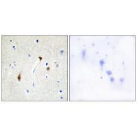 Hairless Antibody in Immunohistochemistry (Paraffin) (IHC (P))