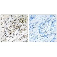 CDYL2 Antibody in Immunohistochemistry (Paraffin) (IHC (P))