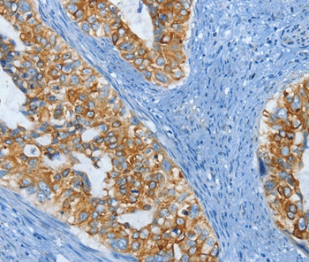 KRT81 Antibody in Immunohistochemistry (Paraffin) (IHC (P))