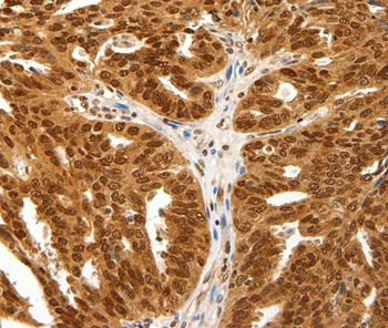 PDCD6 Antibody in Immunohistochemistry (Paraffin) (IHC (P))