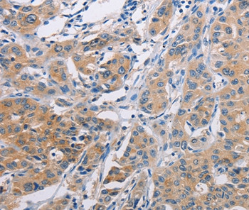 AGBL5 Antibody in Immunohistochemistry (Paraffin) (IHC (P))