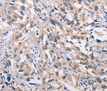 ALG8 Antibody in Immunohistochemistry (Paraffin) (IHC (P))