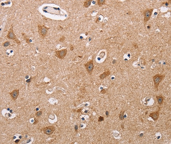 ALG9 Antibody in Immunohistochemistry (Paraffin) (IHC (P))