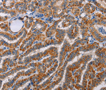 ALG9 Antibody in Immunohistochemistry (Paraffin) (IHC (P))