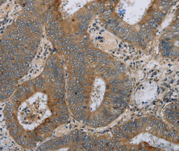 HSD17B14 Antibody in Immunohistochemistry (Paraffin) (IHC (P))