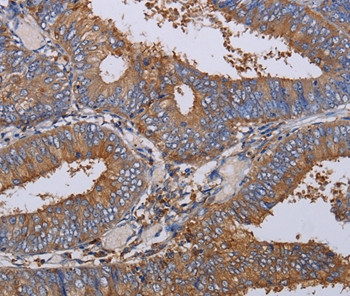 LIMS1 Antibody in Immunohistochemistry (Paraffin) (IHC (P))