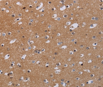 MKKS Antibody in Immunohistochemistry (Paraffin) (IHC (P))