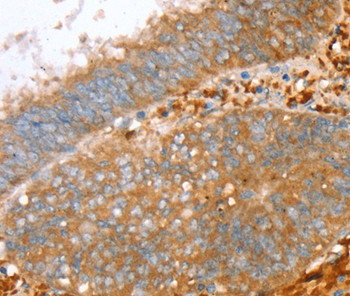 PTPN7 Antibody in Immunohistochemistry (Paraffin) (IHC (P))