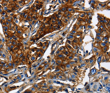 MRP5 Antibody in Immunohistochemistry (Paraffin) (IHC (P))