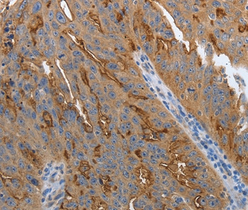 SLC34A2 Antibody in Immunohistochemistry (Paraffin) (IHC (P))