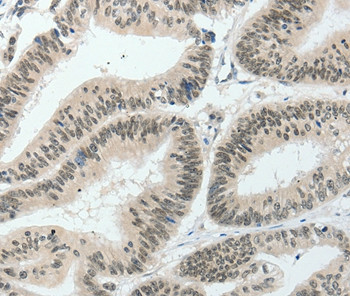 TCF2 Antibody in Immunohistochemistry (Paraffin) (IHC (P))