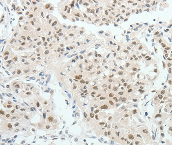 TCF2 Antibody in Immunohistochemistry (Paraffin) (IHC (P))