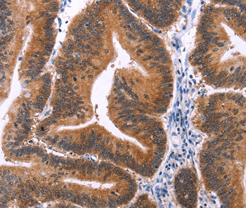 SAPK4 Antibody in Immunohistochemistry (Paraffin) (IHC (P))