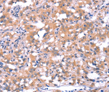 FAT1 Antibody in Immunohistochemistry (Paraffin) (IHC (P))