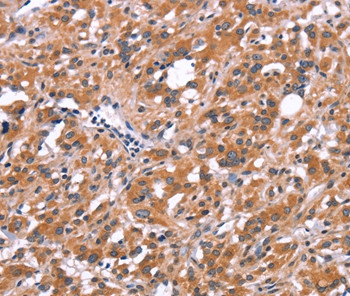 FDCSP Antibody in Immunohistochemistry (Paraffin) (IHC (P))